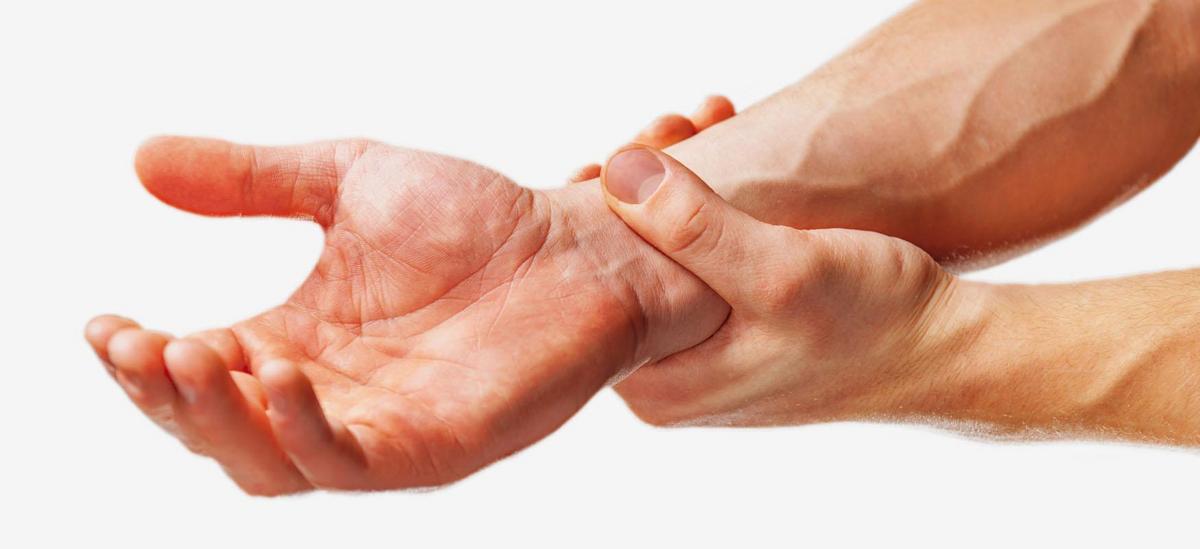 Medical illustration showing hand with Dupuytren's disease, fingers bent inwards.