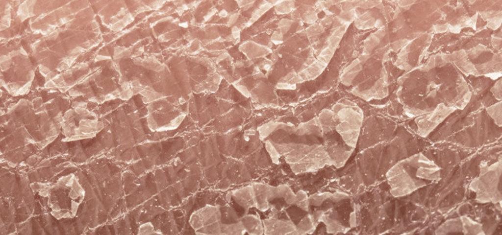 Close-up view of textured fish scales displaying shiny, overlapping patterns.