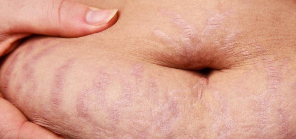 Procedimientos de ginecología estética posparto para restaurar y mejorar el bienestar femenino.