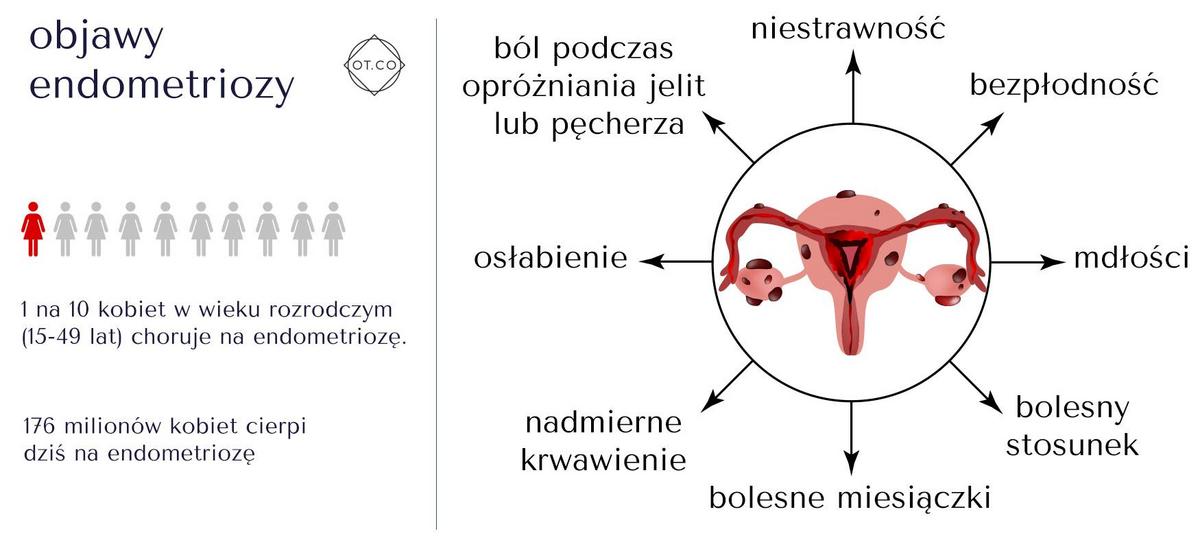 A medical illustration depicting endometriosis affecting reproductive organs, with highlighted inflammation areas.