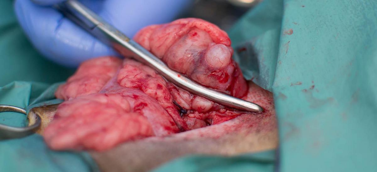 Ultrasound image showing a fluid-filled ovarian cyst in the pelvic region.