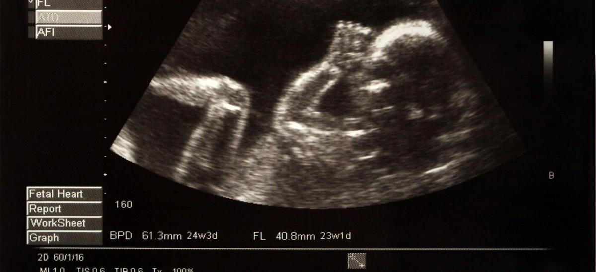 Test prenatale con immagine rappresentativa di cure mediche durante la gravidanza.