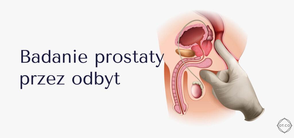 Prostate diagram showing its location below the bladder, surrounding the urethra.