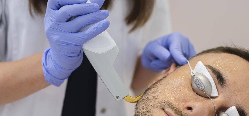 Laser treatment procedure with focused light beam targeting skin for medical or cosmetic purposes.