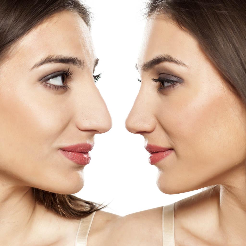 Minimally Invasive Plastic Surgery Techniques Transforming the Industry