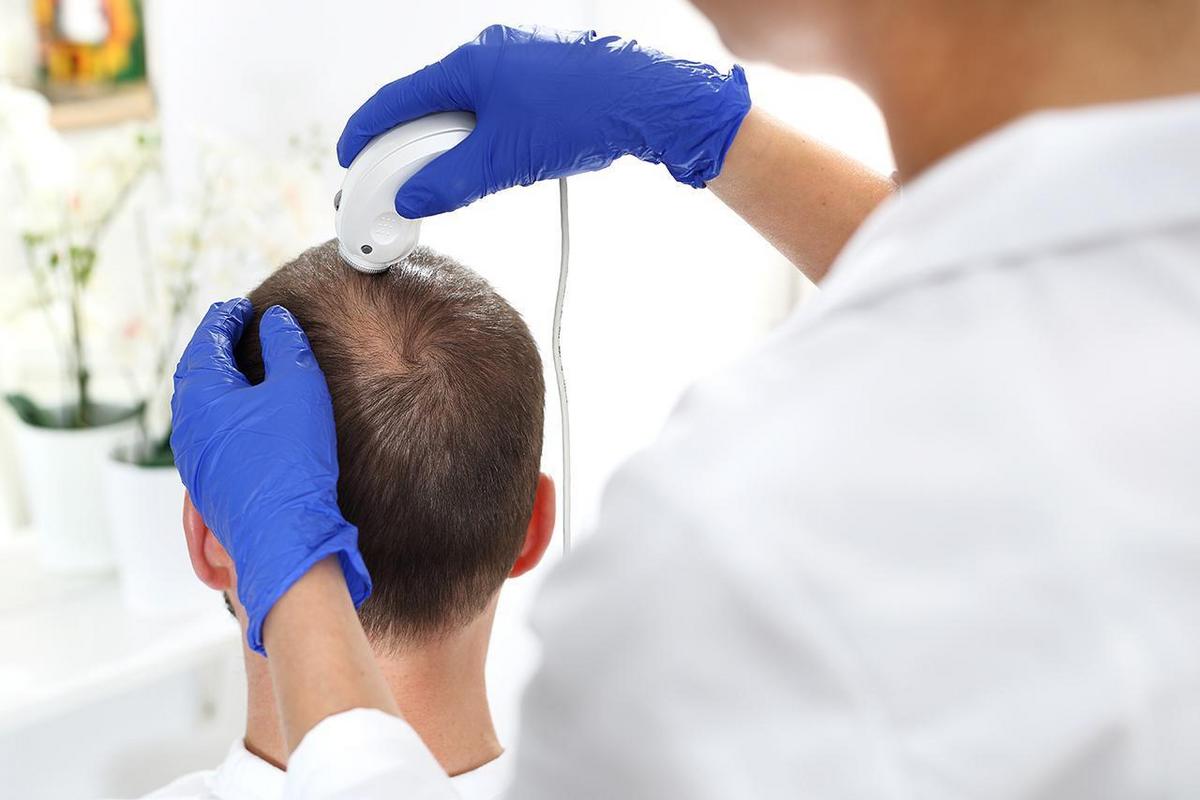 Image showing a person receiving a scalp treatment consultation for hair restoration.