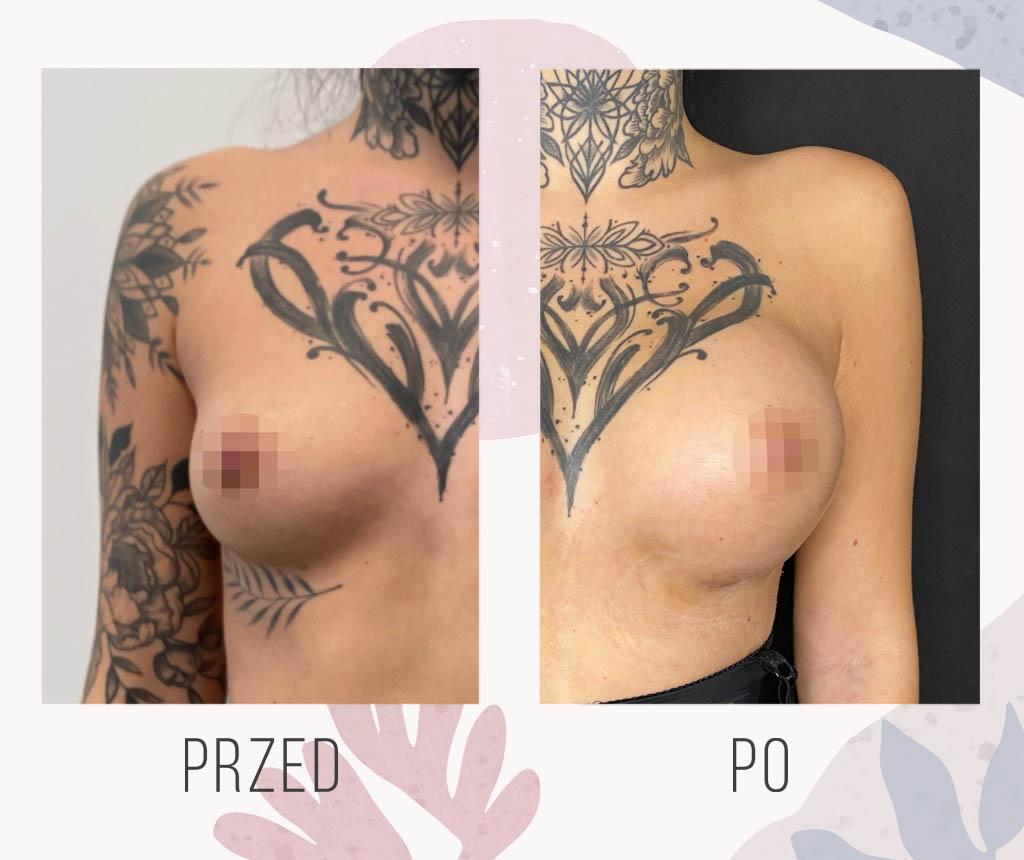 Alt text: A visual comparison of age-defying surgery process and outcomes.