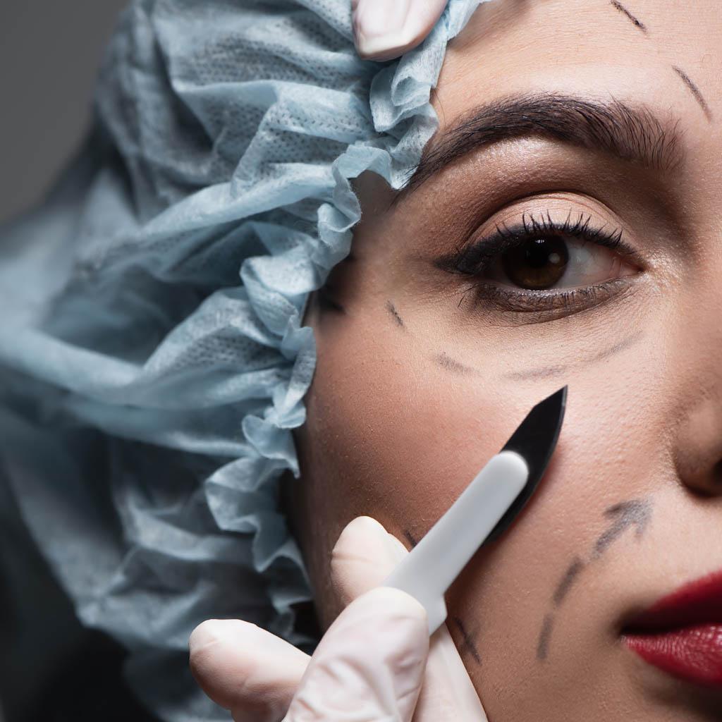 What Should You Consider Before and After Eyelid Surgery