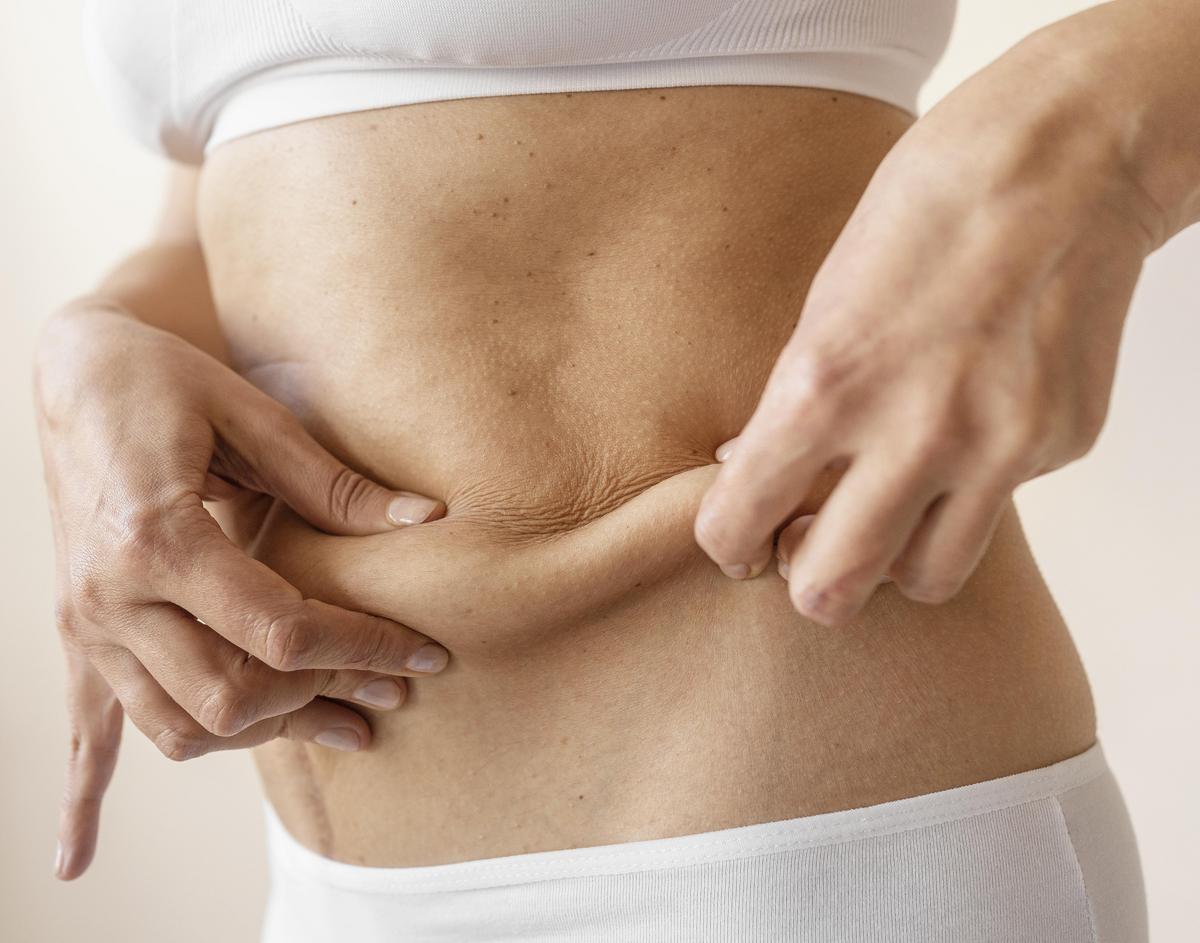 Alt text: Comparison of safest, most effective liposuction techniques for optimal results.