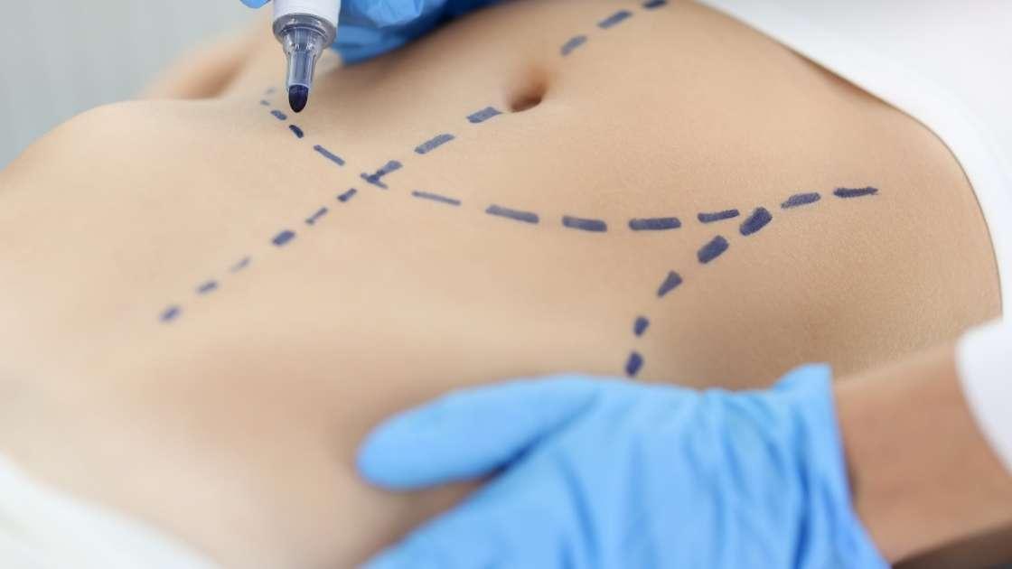 Plastic surgery options for post-pregnancy or weight loss transformations.
