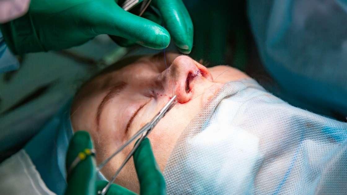 Recovery process after nose surgery illustrated with 9 images.
