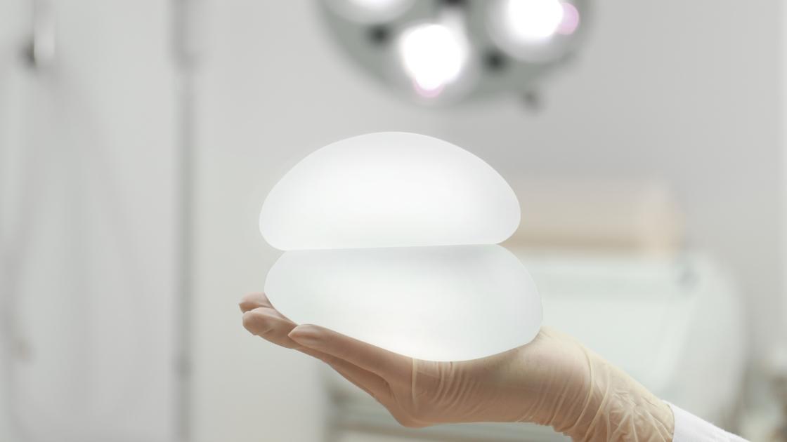 Breast implant replacement surgery process illustrated step by step in image.