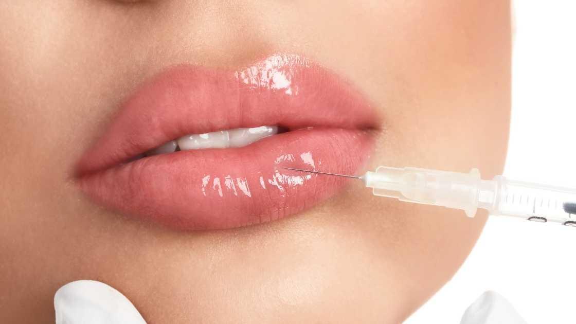 Cost of lip augmentation in Warsaw varies. Image alt text: 