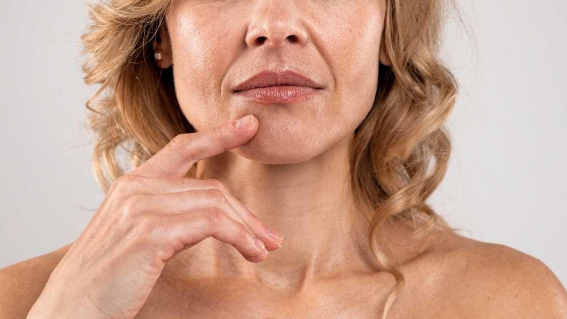 Home remedies to lift corners of mouth: smiling exercises, facial yoga, hydration.