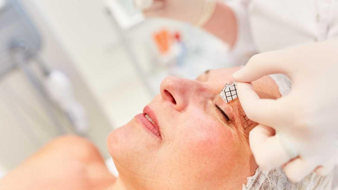 Causes of double eyelids: genetics, aging, surgery.