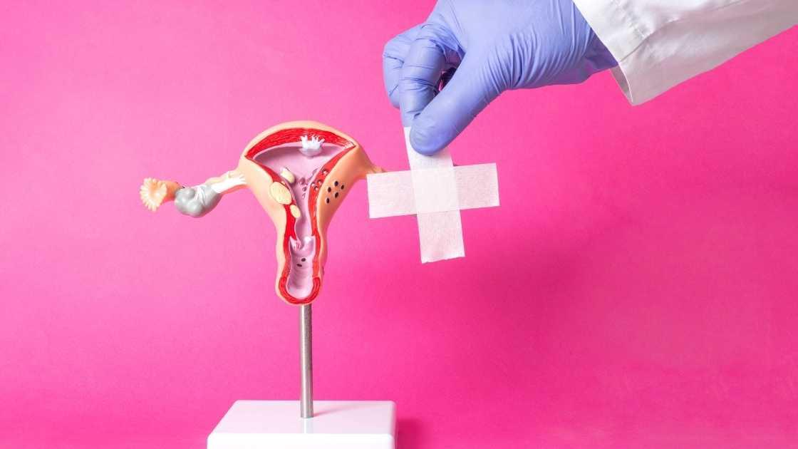 A labioplasty surgery setup with medical instruments on a sterile blue table.