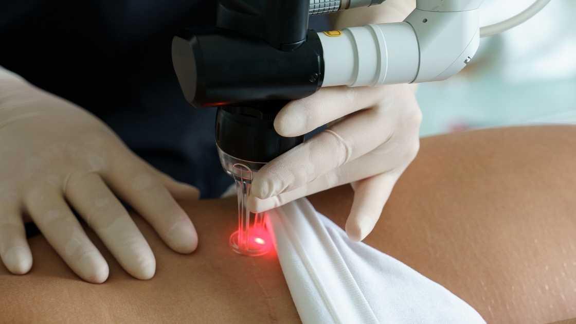 Laser scar removal process showing before-and-after images with smooth skin results.