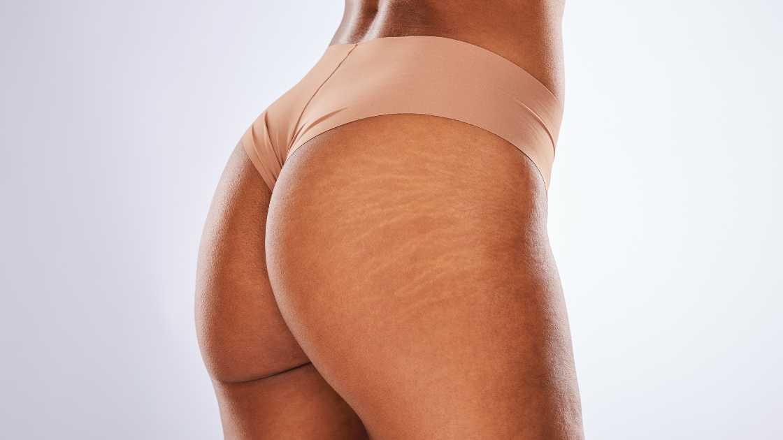 What are the indications and contraindications for carboxytherapy?