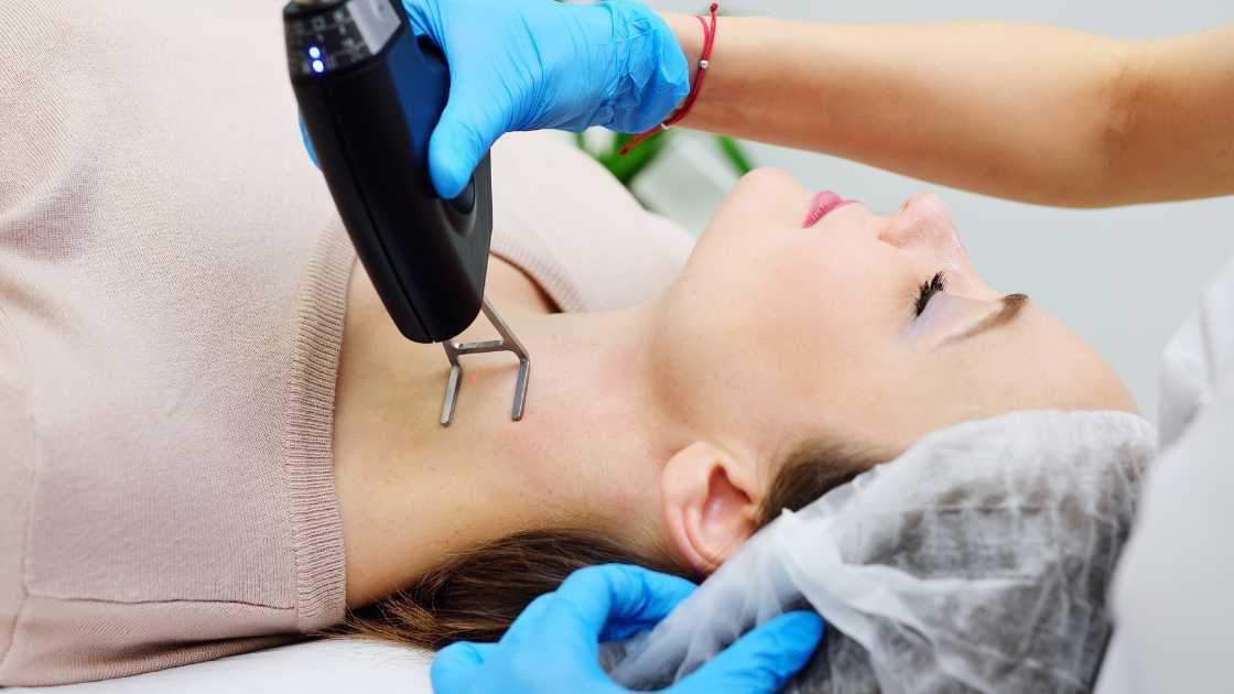 CO2 fractional laser treatment in action on skin surface close-up.