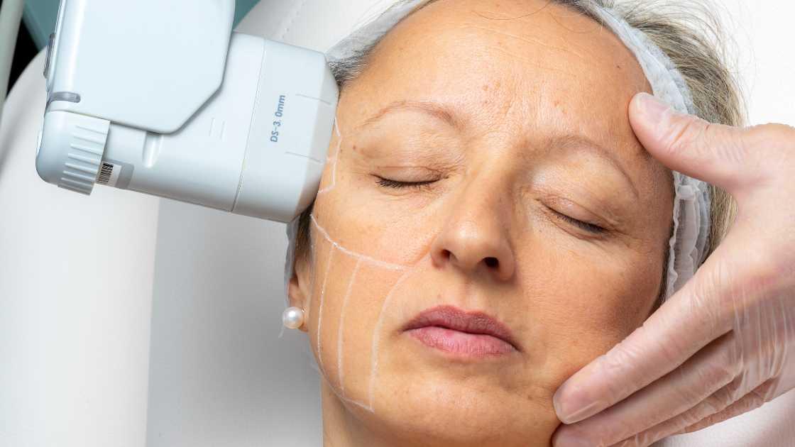 What results can be achieved after HIFU treatment?